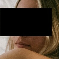 AloeForThatBurn Meztelen