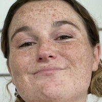 freckledbabyy Meztelen