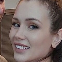 mosttalentedbaldman Meztelen