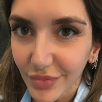 patena24free Meztelen