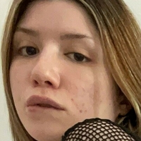 sumchloefree Meztelen