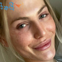 Tyler Loren Meztelen